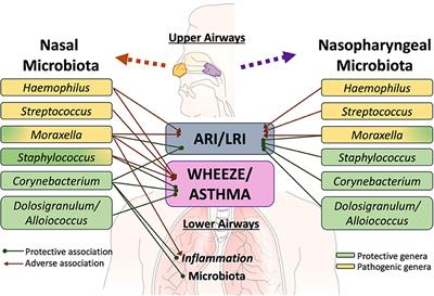 Human Respiratory and Gut Microbiomes—Do They Really Contribute to Respiratory Health?